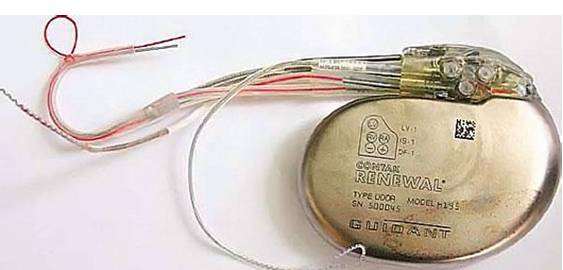 牙齿有金属填充物能不能做磁共振,做磁共振身上带金属会伤害身体吗