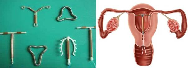 牙齿有金属填充物能不能做磁共振,做磁共振身上带金属会伤害身体吗