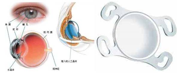 牙齿有金属填充物能不能做磁共振,做磁共振身上带金属会伤害身体吗