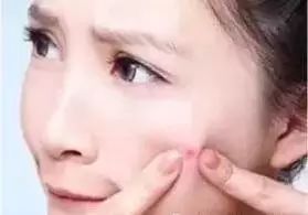 皮肤瘙痒水泡破了怎么处理,皮肤上起红疹且有水泡瘙痒