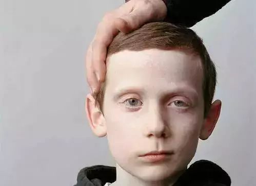 山东老中医治疗面瘫在哪里,濉溪80多岁老中医治面瘫