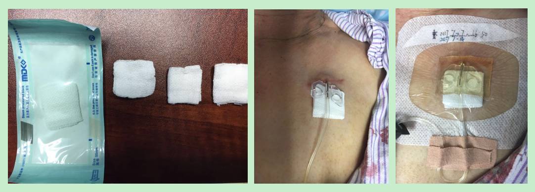 杈撴恫娓澏褰㈤拡绌垮埡瑙嗛,杈撴恫娓澏缈奸拡绫诲瀷