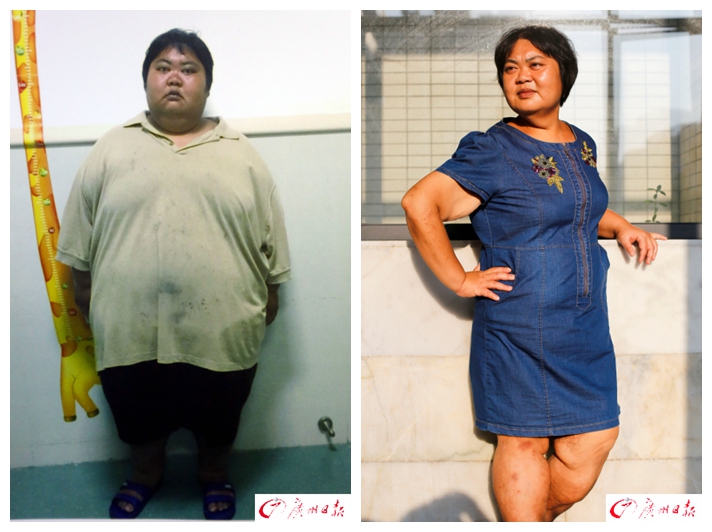 胖女减肥300斤,胖女孩一月减重二十多斤