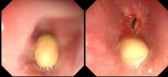 消化内镜都是消化内科医生做的吗,消化内科医生做内镜吗