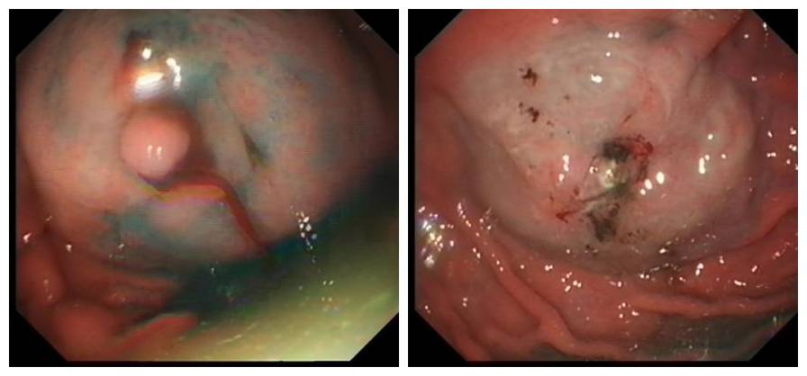 消化内镜都是消化内科医生做的吗,消化内科医生做内镜吗