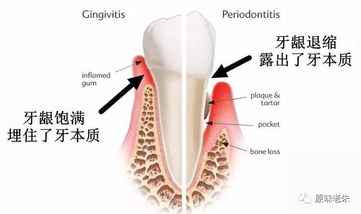 920爱牙日·牙齿酸软请心疼自己，80%的解决办法都在这里了，请自取