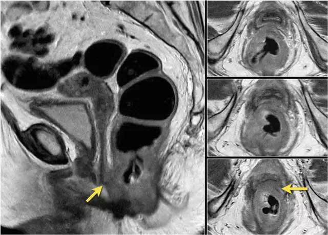 记住一个单词的一般方法,记住癌症九字诀