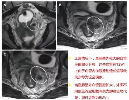 记住一个单词的一般方法,记住癌症九字诀