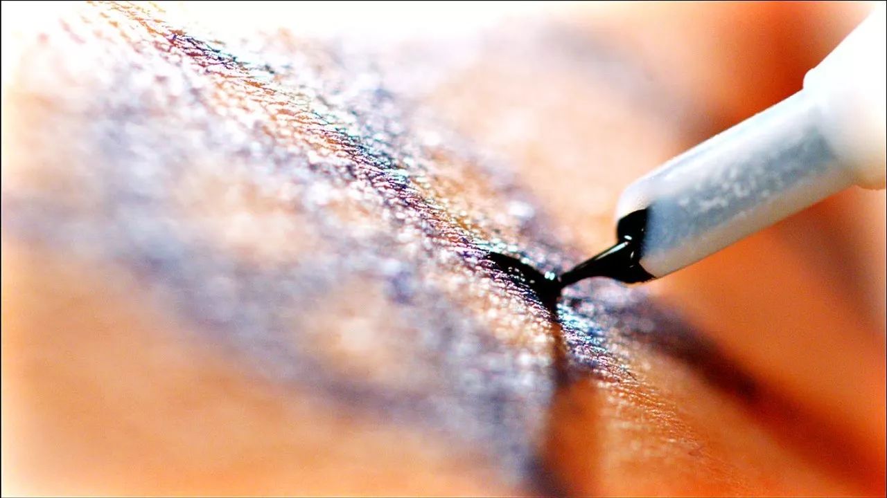 纹身油墨对人体的危害,纹身墨水涂在身上有什么危害