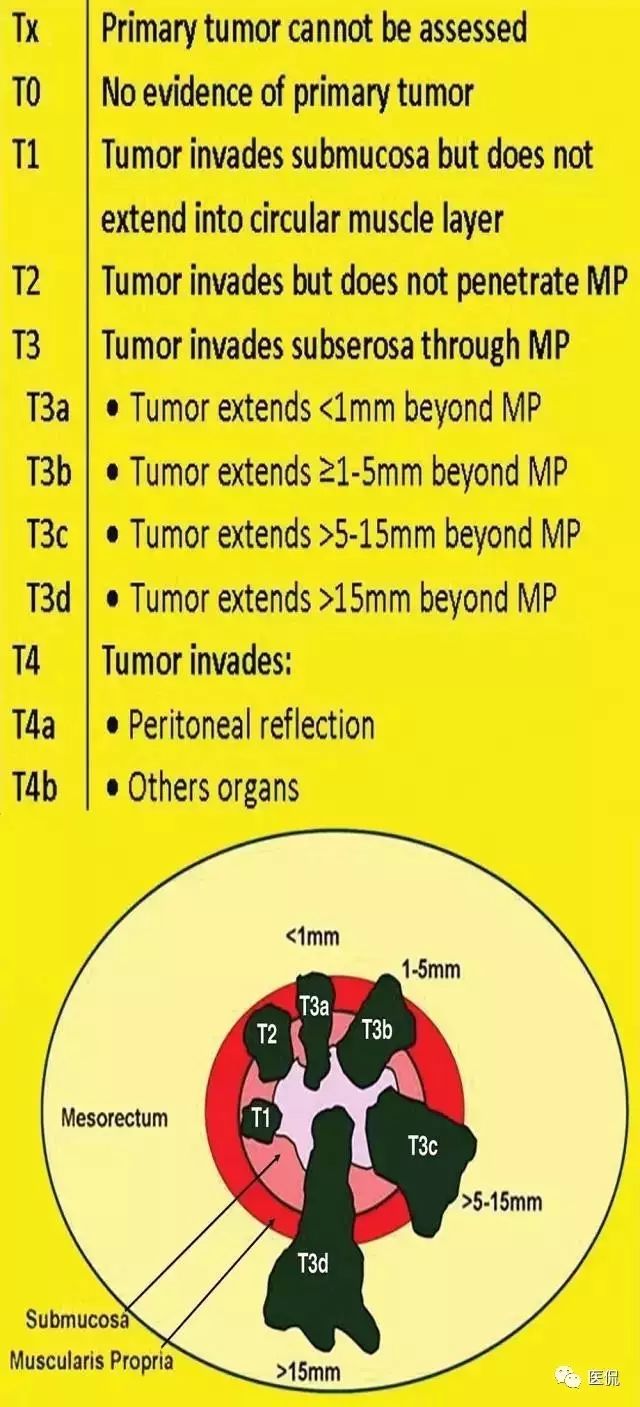 记住一个单词的一般方法,记住癌症九字诀