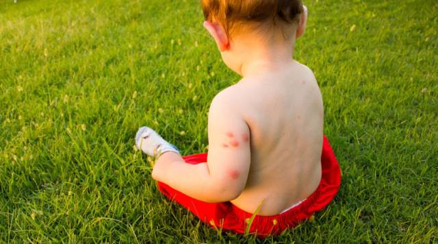 出门旅游宝宝发烧怎么办,孩子旅行中发烧怎么处理