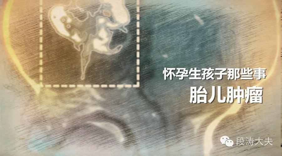 胎儿没出生就长了肿瘤,怀孕多久可以查出胎儿肿瘤