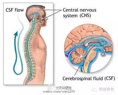 脊柱手术脑脊液漏多久愈合,腰椎手术后脑脊液漏能自我修复吗