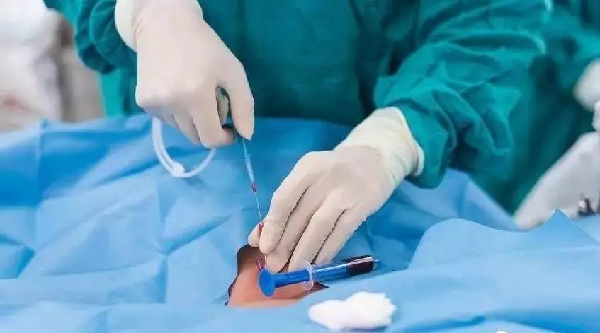 颈部血透导管一般是长期还是临时,颈内静脉临时导管的固定