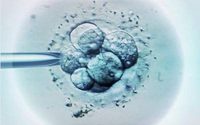 重庆医学界又出大新闻，谁说白内障青光眼不可逆……