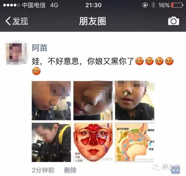 小小年纪竟然得了鼻炎,小小年纪鼻炎