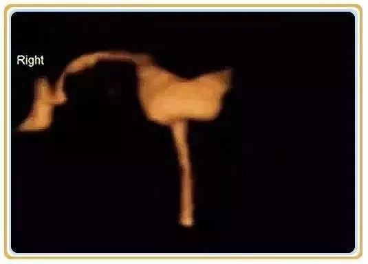 小生命的真实存在,小生命怎么开始的