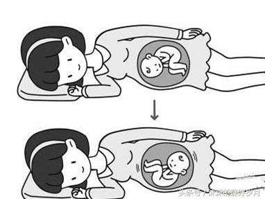 孕26周宝宝臀位还能转过来吗,孕晚期胎宝宝还是喜欢臀位