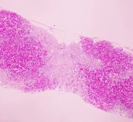 怎么看懂尿常规化验单,一文教你看懂肝功能报告单