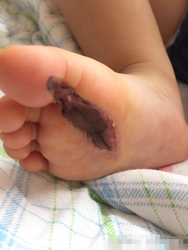 家有宝宝的时刻关注孩子的牙齿,家有宝宝的家长请关注