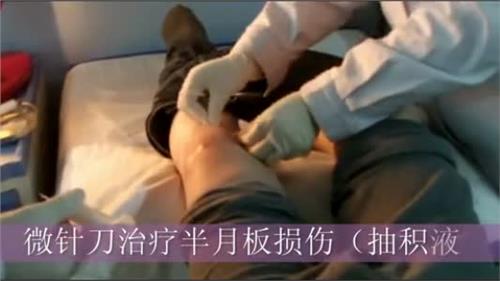 半月板损伤可以跑步锻炼腿肌肉吗,半月板已经损伤了如何跑步