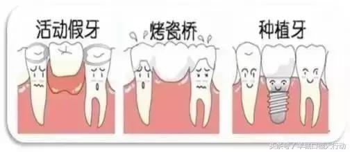 小孩牙齿先天性缺失怎么办,牙齿缺失了到底怎么办