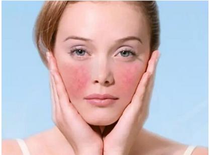 眼白血丝消除最快方法,用什么方法可以快速消除红血丝