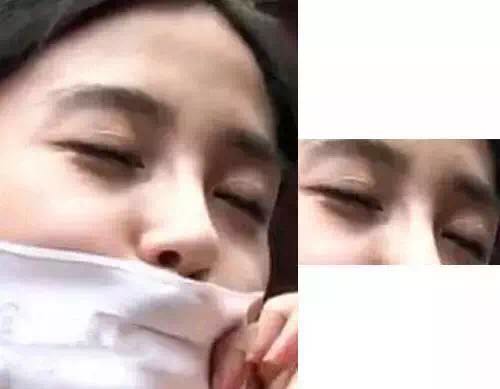 杨幂眼皮松弛怎么补救的,杨幂眼睛肿了怎么回事