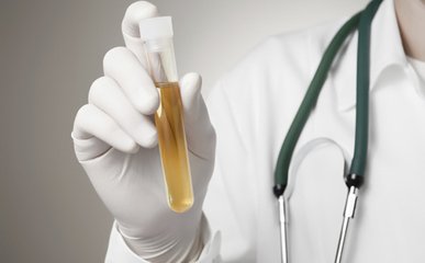 尿泡多就一定是蛋白尿吗,一泡尿从黄到清正常吗