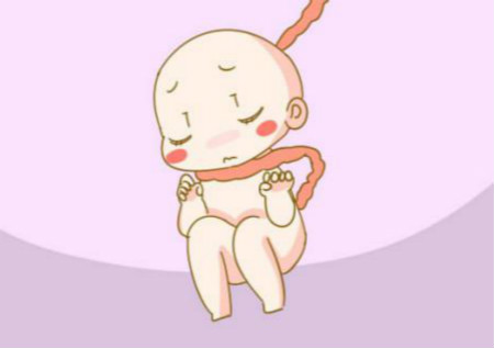 胎儿脐带绕颈缺氧孕妇有什么感觉,脐带绕腹有点紧怎么办