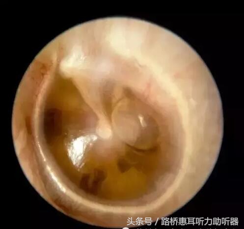 惠耳助听器温岭,台州惠耳听力助听器