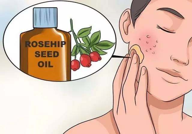 毛孔粗大收缩毛孔最有效的方法,收缩毛孔粗大最快最有效的方法