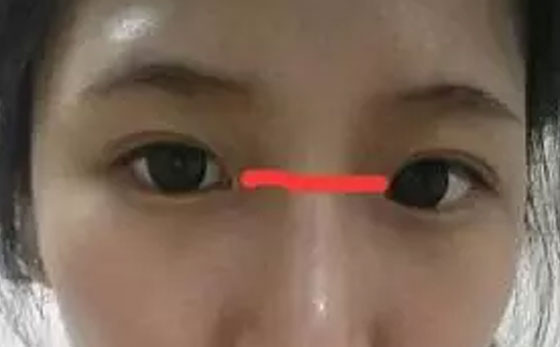 夏季心脏不好的人千万别做三件事,怎么才能养心对心脏好