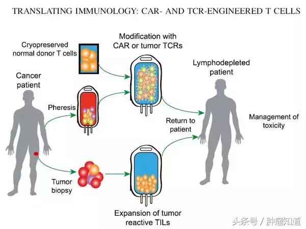 car-t最新治愈进展,三分钟深度了解cart疗法