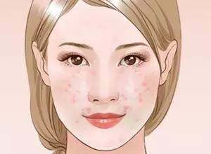 毛孔粗大收缩毛孔最有效的方法,收缩毛孔粗大最快最有效的方法