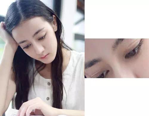 杨幂眼皮松弛怎么补救的,杨幂眼睛肿了怎么回事