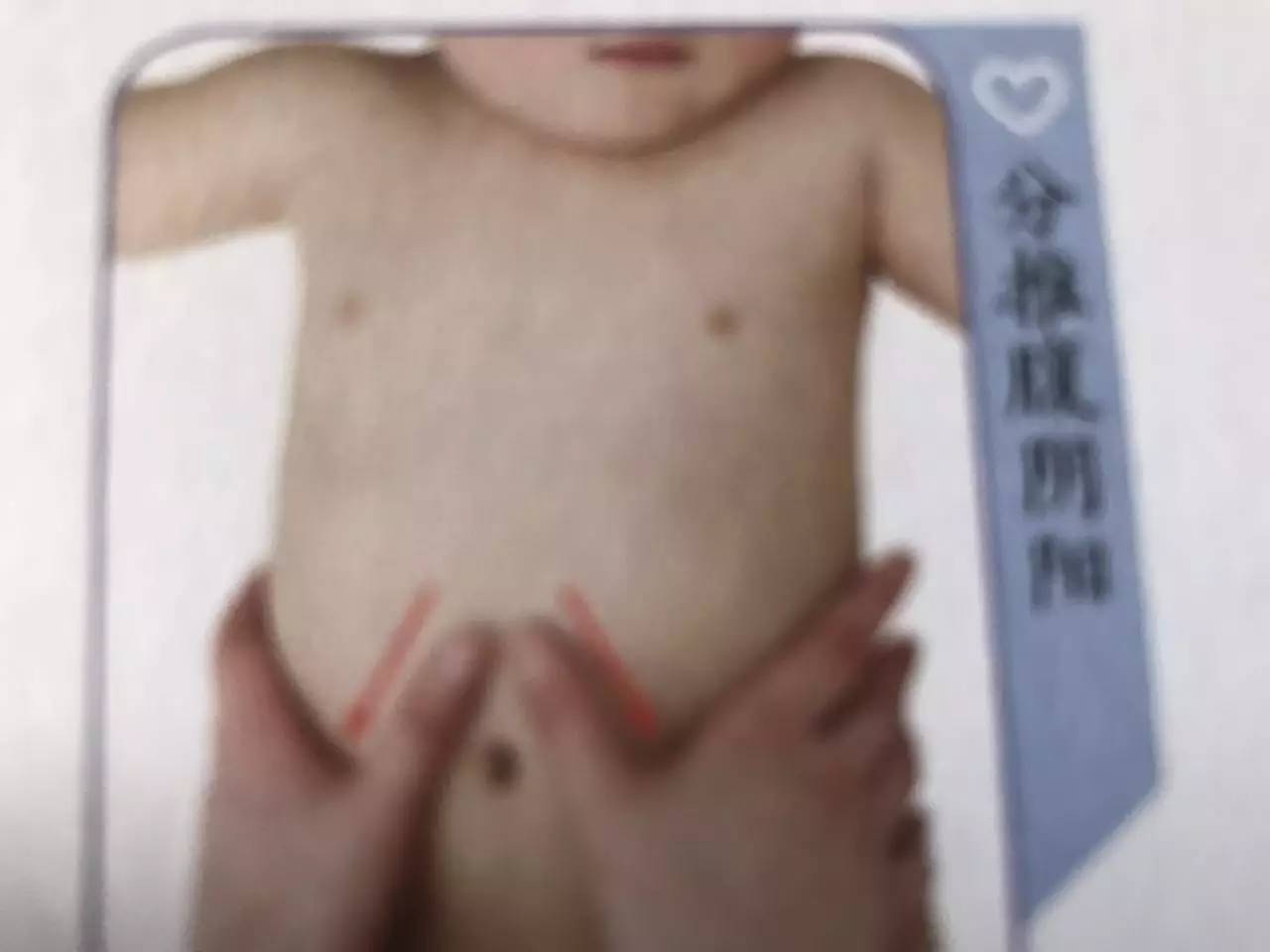 宝宝腹泻的五种类型及推拿手法,宝宝腹泻的6个治疗偏方