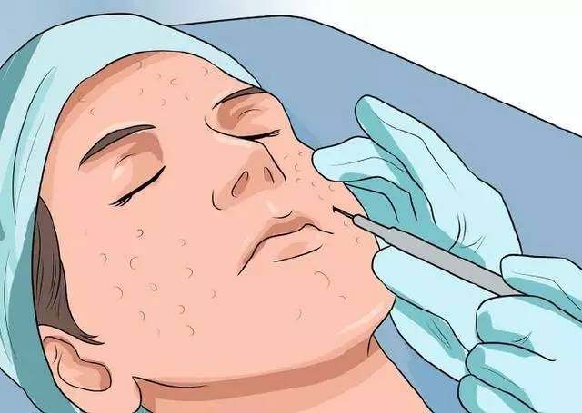 毛孔粗大收缩毛孔最有效的方法,收缩毛孔粗大最快最有效的方法