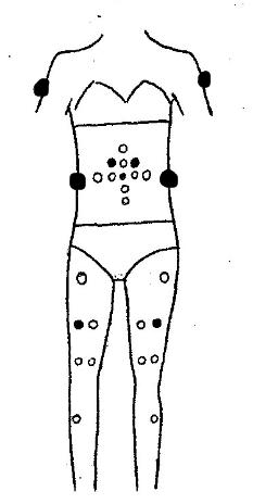 一测你适合哪种减肥方案,测试一下你减肥的可能性有多大