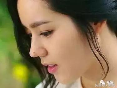 做了个达拉斯隆鼻，假体直接戳到脑门，我是不是和张檬、刘雨欣遇到了同一个医生！