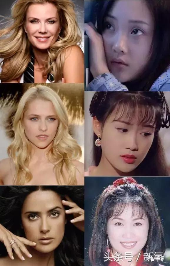 做了个达拉斯隆鼻，假体直接戳到脑门，我是不是和张檬、刘雨欣遇到了同一个医生！