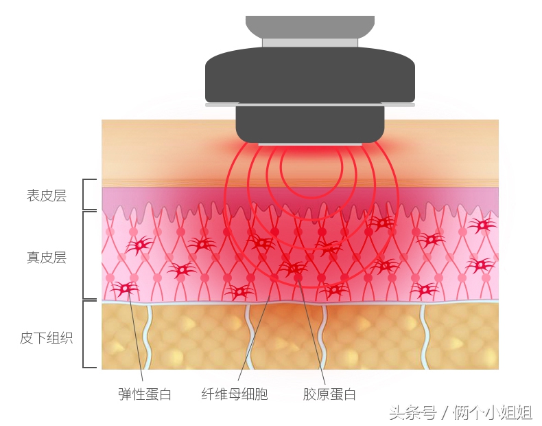 七种网红美容仪,现在比较流行的美容仪有哪款