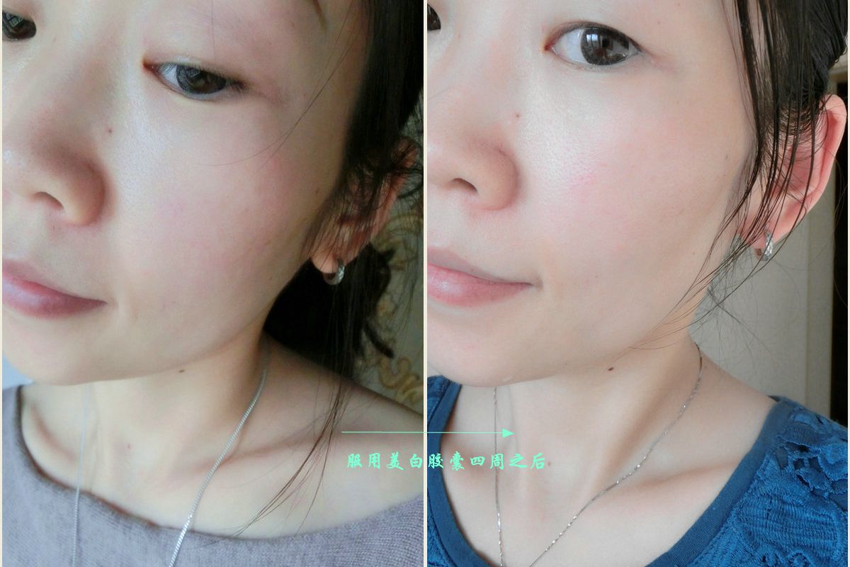 28天见证美白奇迹,肌肤自然美白之旅