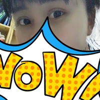 双眼皮松弛全切恢复过程,全切双眼皮几天可以洗脸