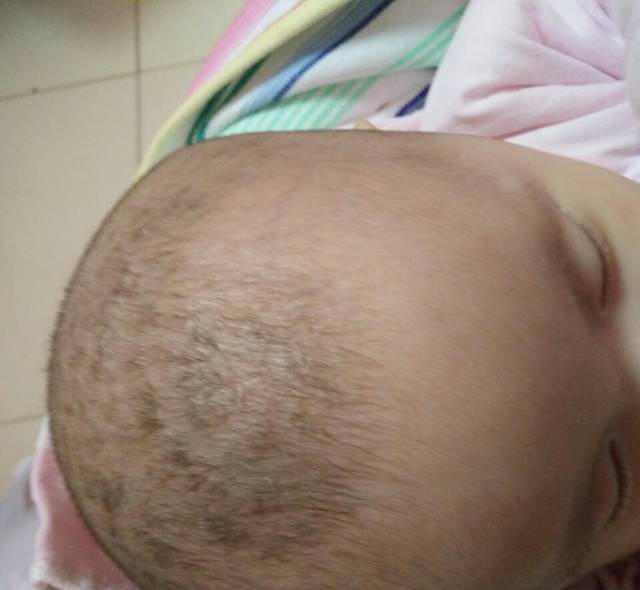 宝宝囟门异常表现,宝宝囟门出现这4个异常情况