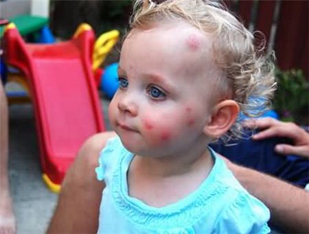 驱蚊液成分怎么选,驱蚊液关注事项避免儿童接触