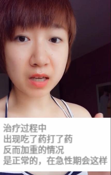 病毒性气管支气管炎症状,急性毛细支气管炎的最佳治疗