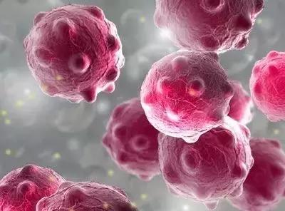 18岁女孩腹泻三天的住院记录,17岁女生得厌食症死亡