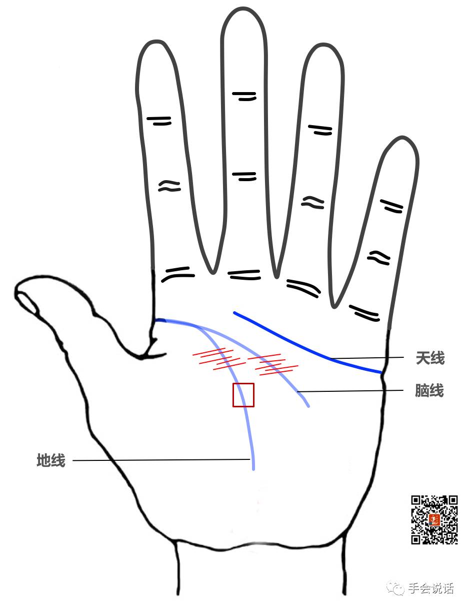 手掌手指长疣是什么原因,手掌比手指长怎么回事