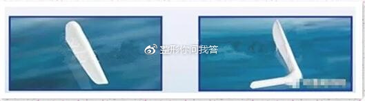 做假体下巴用硅胶好还是膨体好,下巴假体是做膨体好还是硅胶好